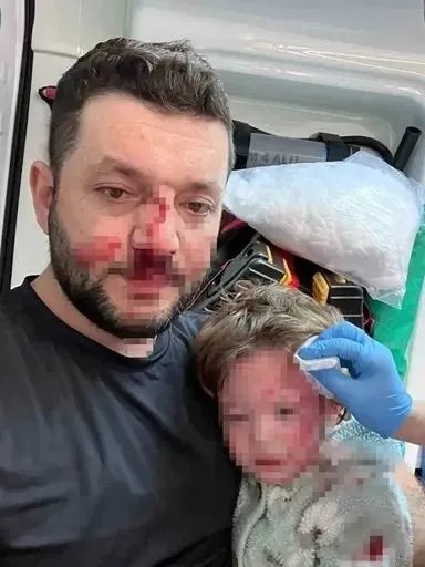 Yalova'daki Vahşete Jet İddianame! Baba Ve Kızına Saldırıda Scooter Silah Sayıldı